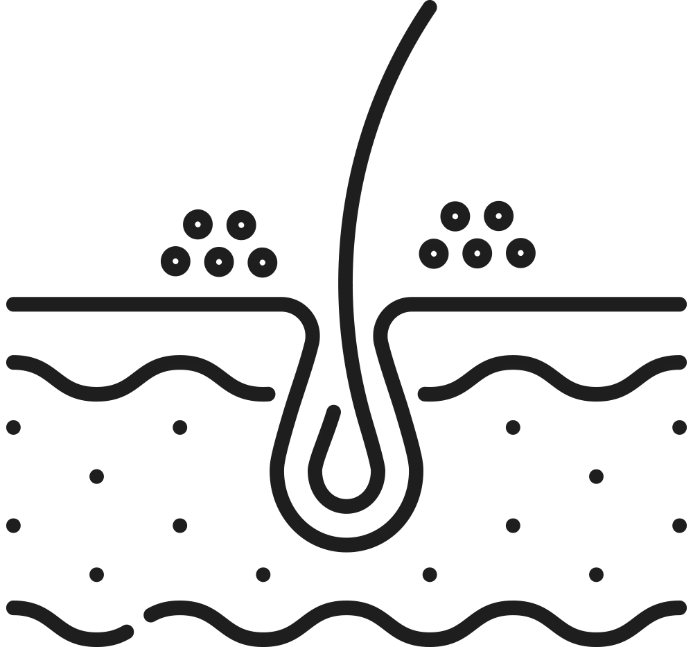 头皮微生态失衡